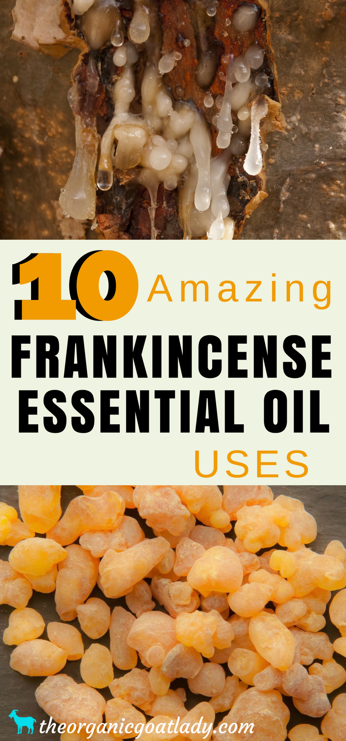 10 Amazing Uses for Frankincense Essential Oil - My Blessed Life™