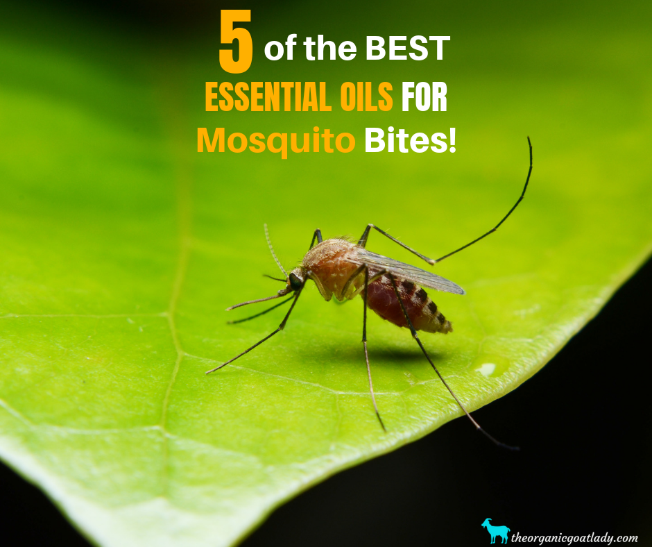 5 Essential Oils For Mosquito Bites