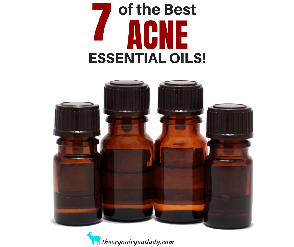 7 Essential Oils For Acne